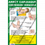 L'AFFICHE DETAILLEE : ARRET CARDIAQUE - COMPRESSIONS - ENFANT