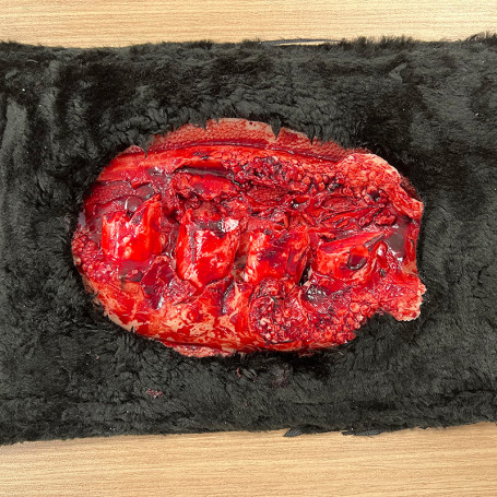 FAUSSE PLAIES DE CHIEN : FRACTURE OUVERTE DES CÔTES