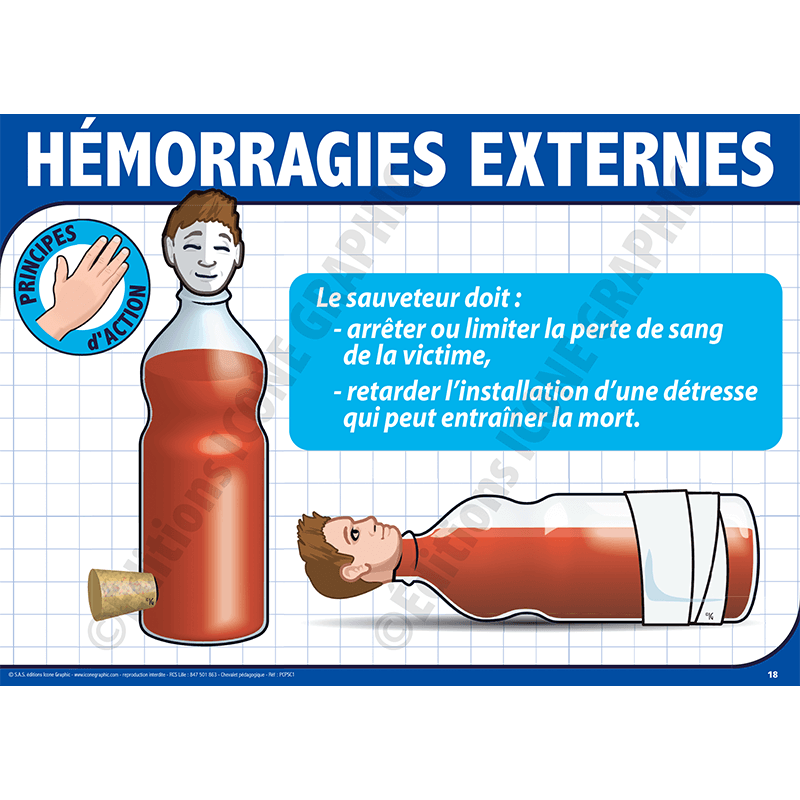 exemple chevalet