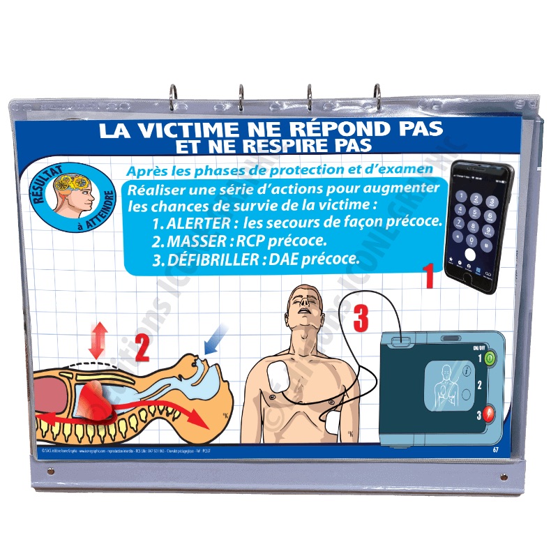 exemple chevalet